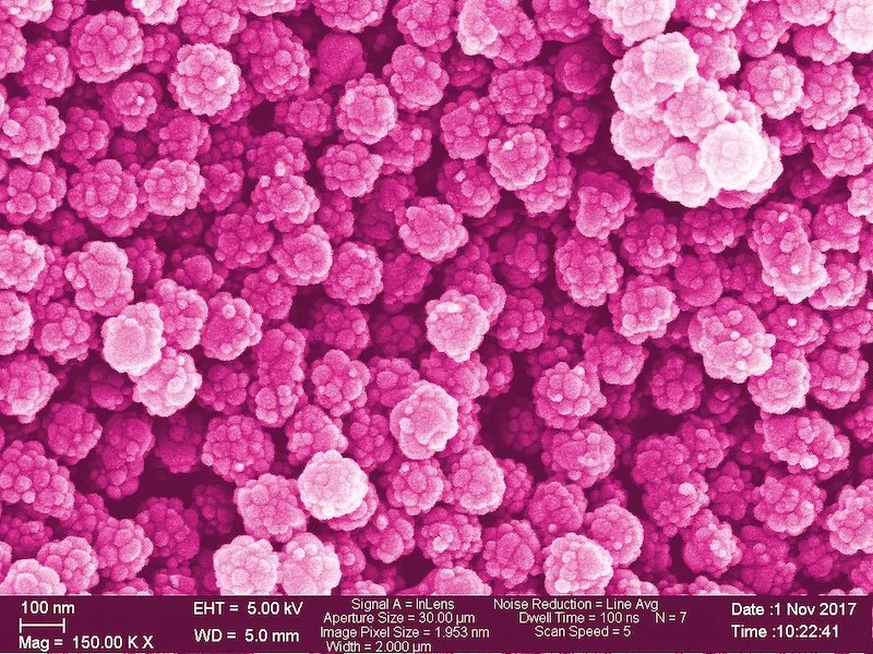 fc5bad4d3805ef820c5d7787ed23c9a88c2891bb Auf dieser nachträglich eingefärbten Aufnahme eines Elektronenmikroskops sehen die Nanoplastik-Teilchen noch ganz schön aus. (Bild Empa / ETH)