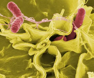 Sekundärelektronenmikroskopaufnahme von Salmonellen (rot eingefärbt). (Bild NIAID)
