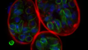 Drei Zysten wie sie im Gehirn von chronisch infizierten Tieren und dem Menschen vorkommen. (Bild UZH)