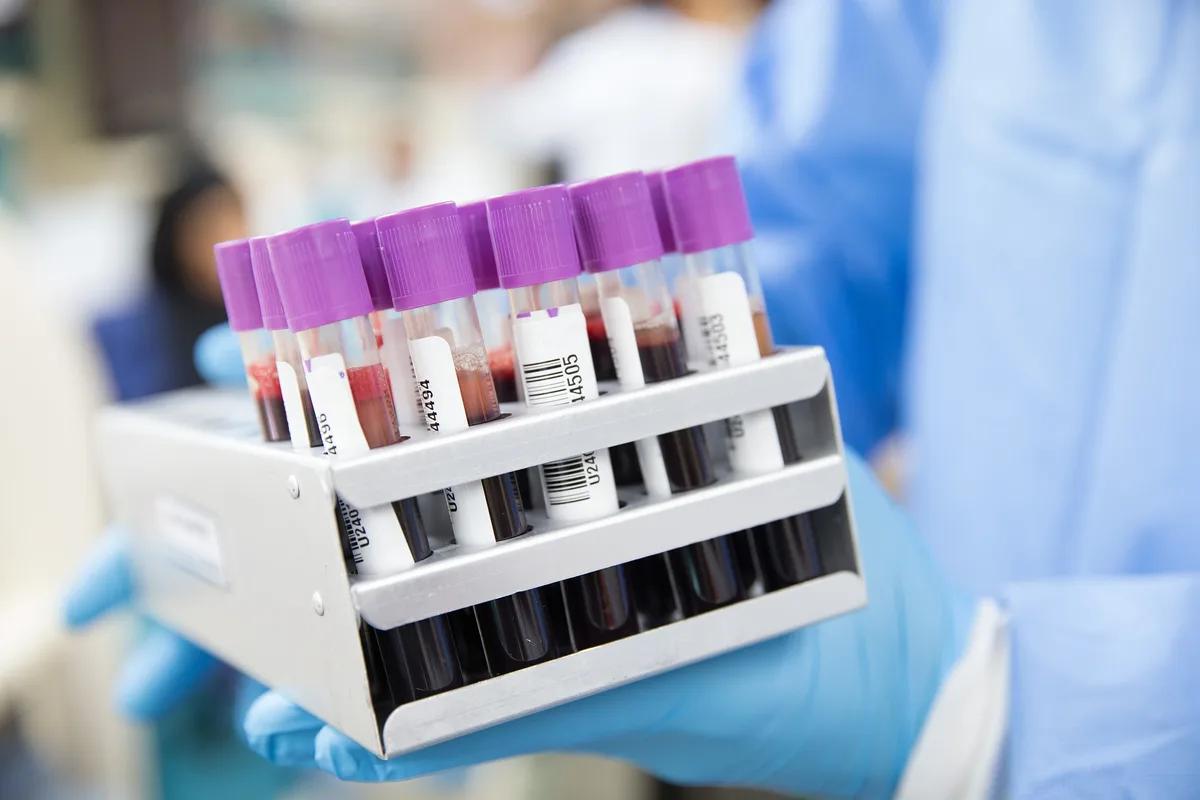 37cdcfe77a73780224f4c02a9538a9f1b13310a8 Im letzten Jahr wurden 7000 Campylobacteriose-Fälle und 1500 Salmonellose-Fälle gemeldet. (Bild Ahmad Ardity/pixabay)