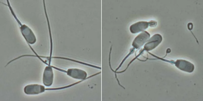 b536c51bc1ca37611bfe483db970001b3160301f Normale Spermien (l.) und solche mit gekrümmten Schwänzen, die sich nicht fortbewegen können. (Bild Hubert Pausch/ETH Zürich)