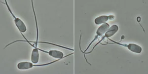 Normale Spermien (l.) und solche mit gekrümmten Schwänzen, die sich nicht fortbewegen können. (Bild Hubert Pausch/ETH Zürich)