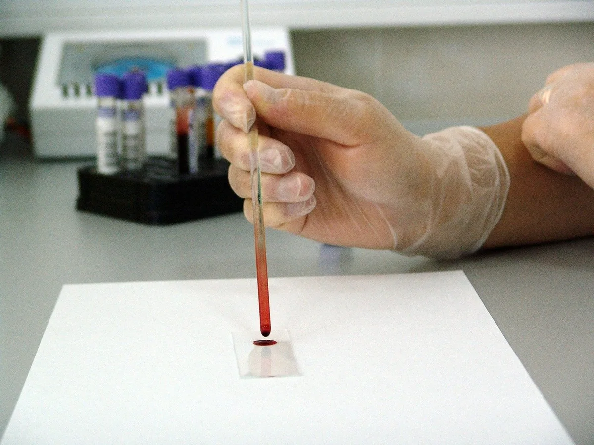 2bd0add7a6525220b745459d74059f35c3f43b1f Parlamentarier wünschen sich mehr Unterstützung für Methoden der Forschung ohne Tierversuche und den Ausstieg aus belastenden Experimenten mit Tieren. (Symbolbild PublicDomainPictures / Pixabay)