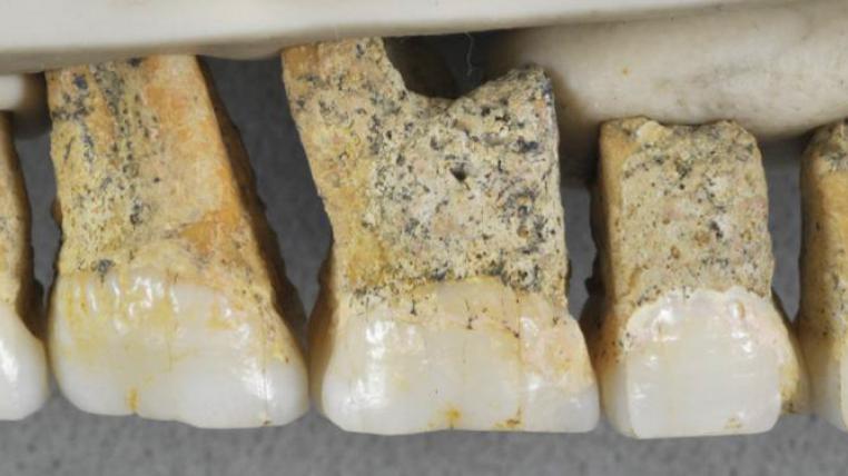 homo-luzonensis-zaehne.jpg