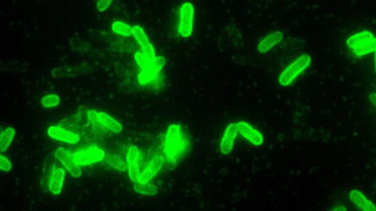 44155d4f00a209dfca4074ddd7c0e033c6dd6ded Yersinia pestis