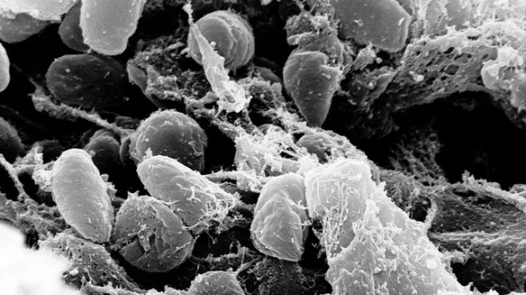 74342b171b61e8e82acc83d89cba87664980e3bf Yerisinia pestis unter dem Elektronenmikroskop