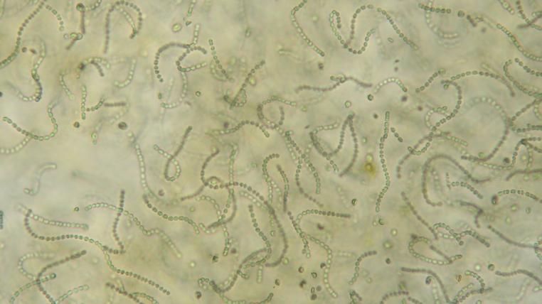 Cyanobakterien